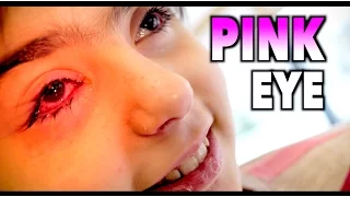 WORST PINK EYE EVER? | Dr. Paul