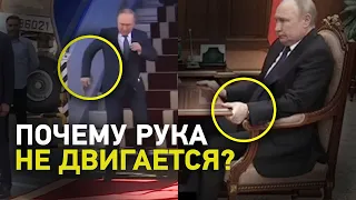 Что с РУКОЙ ПУТИНА? / Здоровье президента ухудшается?!