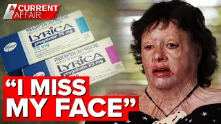 Aussie mum claims prescribed painkiller is to blame for horrific burns | A Current Affair