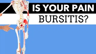 What Is Causing Your Hip Pain? Bursitis? How to Tell.