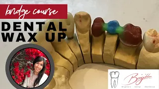 Dental Wax Up - Bridge course with garland [Waxup Tutorial with explanation] for dental study