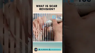 What is Scar Revision? Cosmetic Surgery in Delhi | Dr. PK Talwar