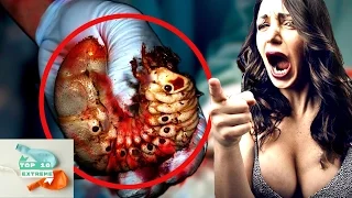 Ten Horrifying Creatures and Things Found Living Inside A Human Body - Top 10 List