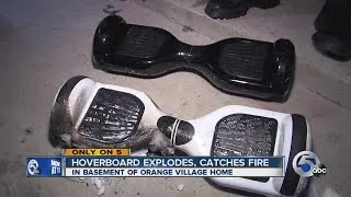 Hoverboard exploded into 5-foot flames, mom says