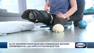 Elite swimmer from Bedford undergoes second experimental leg amputation in Boston