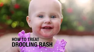 How to treat Drooling Rash