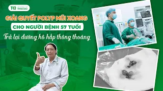 💥Giải quyết Polyp mũi xoang cho người bệnh 57 tuổi