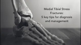 Medial Tibial Stress Fractures: 5 key tips for diagnosis and management