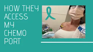 Port Use for Third Chemotherapy Treatment & blood draw - My Cancer Journey Vlog #16 October 13, 2022