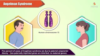 Angelman Syndrome : Pathology and Genetics