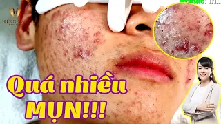 Điều trị mụn viêm, bọc hiệu quả tại TPHCM | Hiền Vân Spa | Acne Treatment |Duy Phương| Part 1| 594