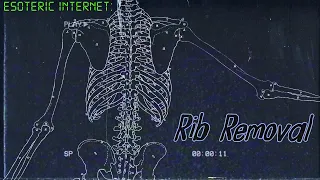 Rib Removal, A Celebrated Superstition | Esoteric Internet
