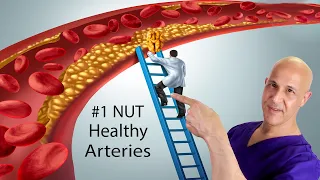 #1 NUT...Clean Arteries, Lower Blood Pressure, Prevent Heart Attack & Stroke | Dr. Mandell