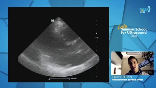 Ultrasound in cardiac arrest - Felipe Terán