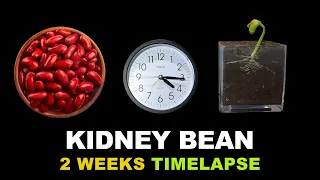 Growing Kidney Bean Time Lapse (2 weeks)
