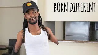 I Was Born With No Arms And One Leg | BORN DIFFERENT
