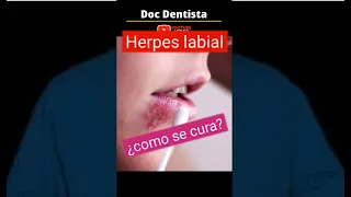 Herpes labial ¿como se cura? #shorts