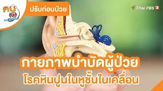 กายภาพบำบัดผู้ป่วย โรคหินปูนในหูชั้นในเคลื่อน | ปรับก่อนป่วย | คนสู้โรค