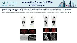How to use PSMA-PET/CT in the Management of Relapsing Prostate Cancer Patients  Webcast (2023)