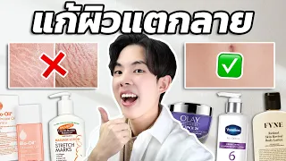 รักษารอยแตกลายให้เห็นผล หยุดเชื่อการตลาดขายฝัน! + เคล็บลับเลือกส่วนผสมที่ไม่มีใครบอกคุณ [ENG SUB]