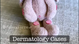 Not Playdough, Not Surgery 🔍🕵🏻‍♂️ - Dermatology Cases