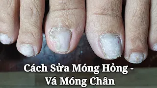 Bài 28: Kỹ Thuật Xử Lý Móng Hỏng và Khôi Phục Móng Hỏng