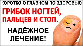 ГРИБОК НОГТЕЙ. 100%-е избавление от грибка ногтей, стоп, ног! Простой метод ДЛЯ ВСЕХ!