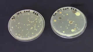 Inquinamento microbiologico dell'acqua