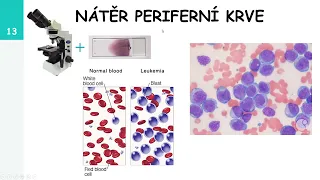 Léčba onemocnění krve, od transfuze po transplantaci kostní dřeně - doc. MUDr. D. Lysák, Ph.D.