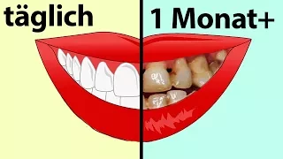 Was passiert, wenn man sich die Zähne nicht mehr putzt?!