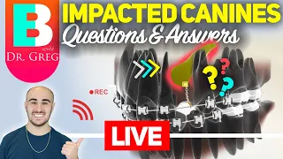 [Braces Explained LIVE, Ep. 06] Impacted Canines Q&A