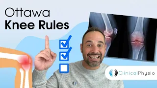 Ottawa Rules for the Knee | Expert Physio Explains