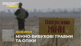 Мінно-вибухові травми та опіки: як допомогти?