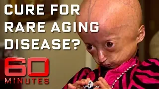 Rare disease ages children eight times faster | 60 Minutes Australia