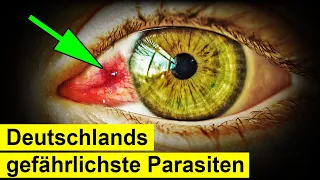 Plötzlich Würmer im Auge! So gefährlich sind sie