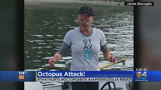 Octopus Bites Woman In Face As She Tries To Take Picture