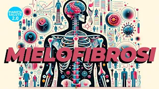 Mielofibrosi: Un Panorama Scientifico e Clinico su Sintomi, Trattamenti e Innovazioni