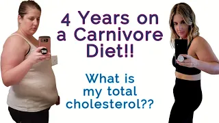 4 Year Carnivore: What is my Total Cholesterol? Full breakdown of my lipid panel on a Carnivore Diet
