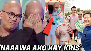 Boy Abunda NAIYAK nang MASAKSIHAN ang SAKIT ni KRIS Aquino! Emosyunal na Reunion PANOORIN!