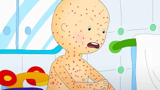 Chicken Pox | Caillou | WildBrain Kids