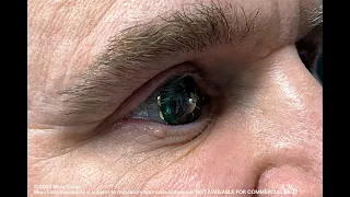 Mojo Vision CEO tested a smart contact lens in his eye!