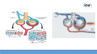 Mechanism of Hypoxemia Associated with Pulmonary Vasodilatation in Patients with COVID-19 Infection.