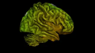 New 3D Brain Map (qEEG)