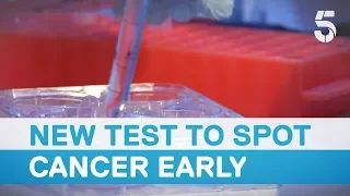 New blood test is 'major breakthrough' in fight against cancer - 5 News
