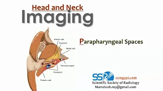 7 para-pharyngeal spaces imaging - prof.Mamdouh Mahfouz (2019 edition)