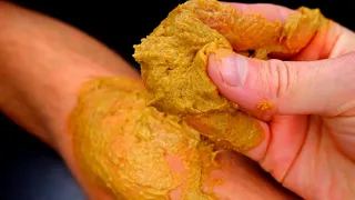 Pain in the knees and joints will go away INSTANTLY FOREVER! Apply this urgently! +15 recipes