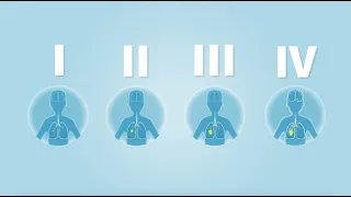 Lungenkrebs – Die verschiedenen Stadien