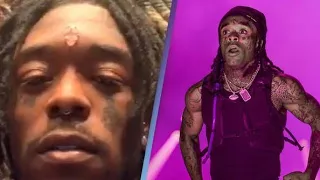 Lil Uzi Vert Says $24 Million Diamond on His Forehead Was Ripped Off by Fans at Music Festival