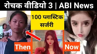 16 साल की लड़की और 100 Plastic surgery | अब हो‌ गई ऐसी शक्ल | Rochak Video 3