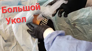 Очень Большой Укол. Я очень доволен результатом. Доктор Уткин.Crazy Doctor